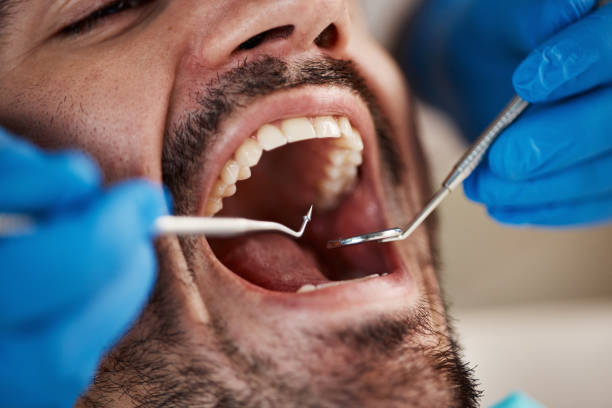 Best Emergency Dental Surgery in Parker, FL